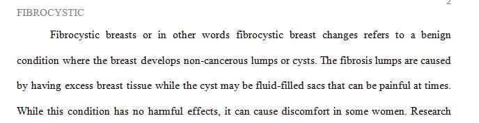 It's not at all uncommon to have fibrocystic breasts